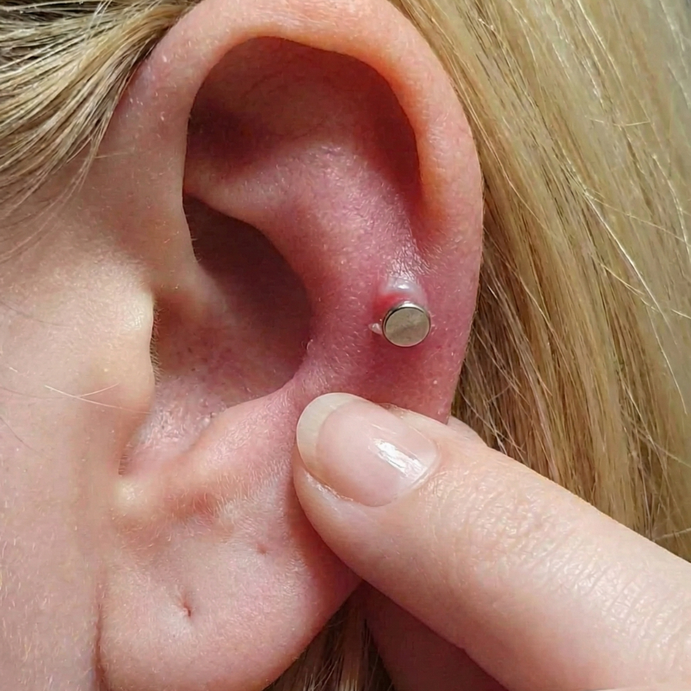 ziarnina na uchu przy kolczyku